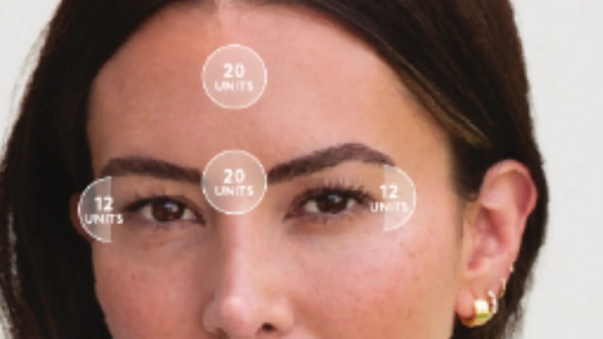 Botox injections gilbert arizona