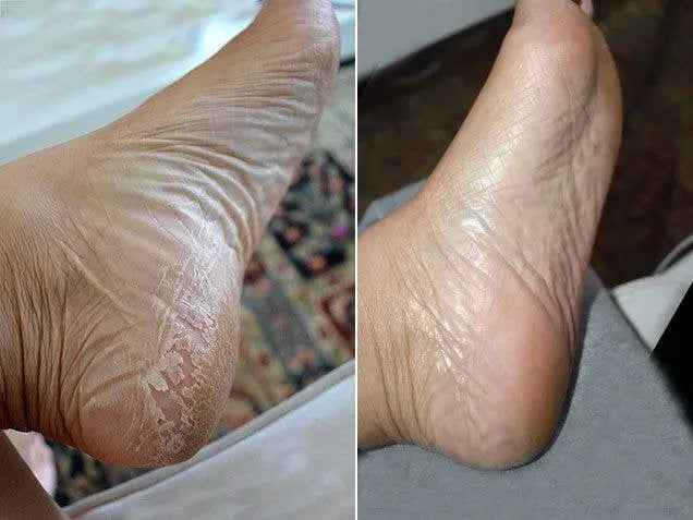 Baby Foot Original Exfoliation Foot Peel BABY FOOT USA Cleanse Face &amp; Body Bar