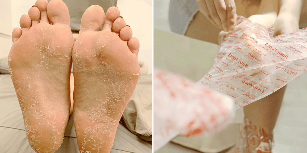 Baby Foot Original Exfoliation Foot Peel BABY FOOT USA Cleanse Face &amp; Body Bar