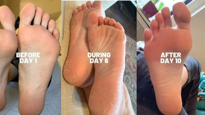 Baby Foot Original Exfoliation Foot Peel BABY FOOT USA Cleanse Face &amp; Body Bar
