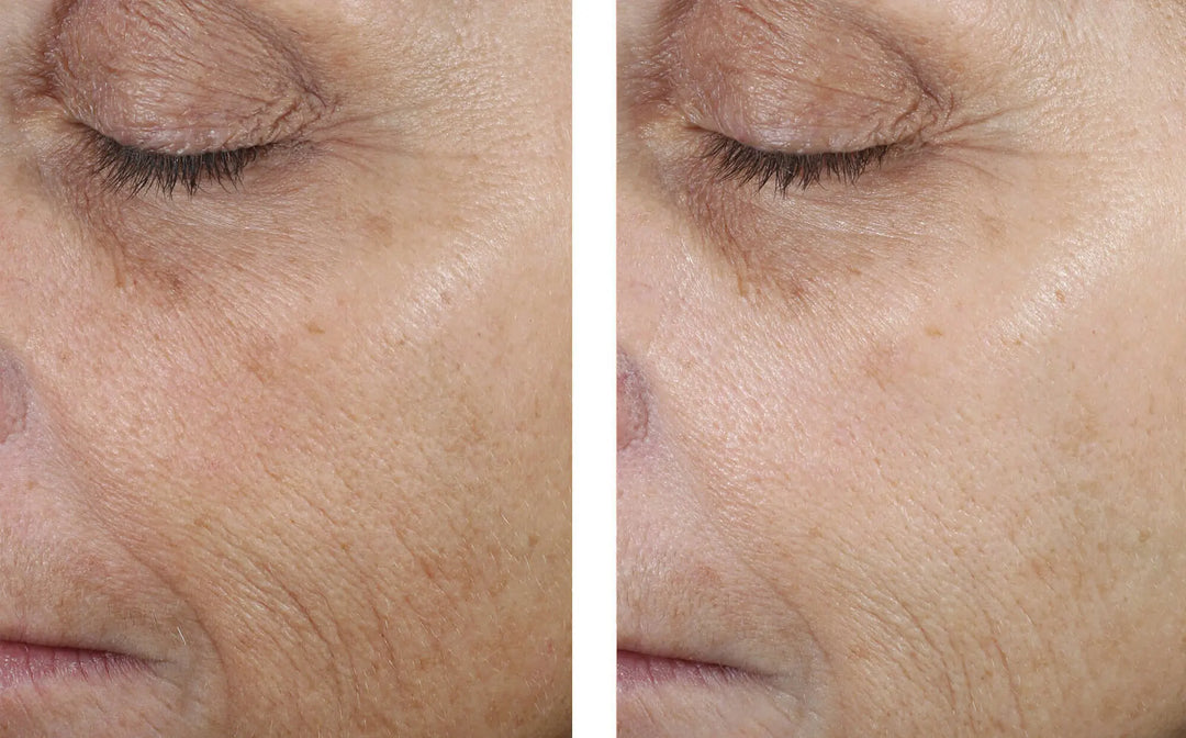 Even Tone Correcting Serum | Skinbetter