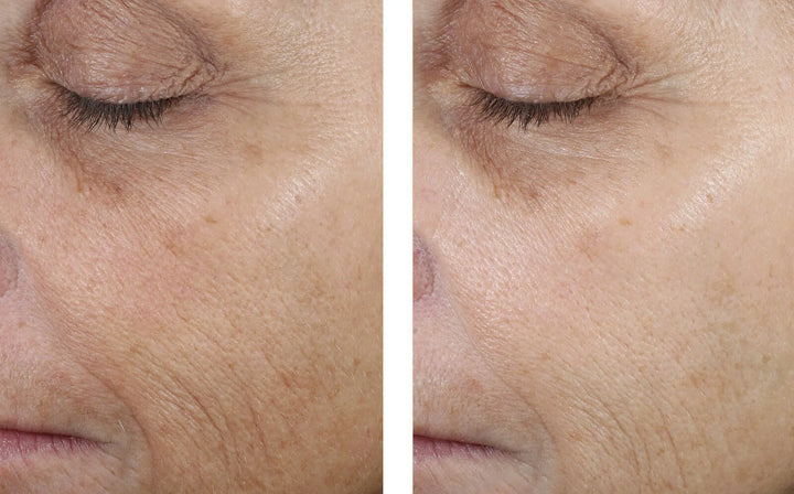 Even Tone Correcting Serum | Skinbetter