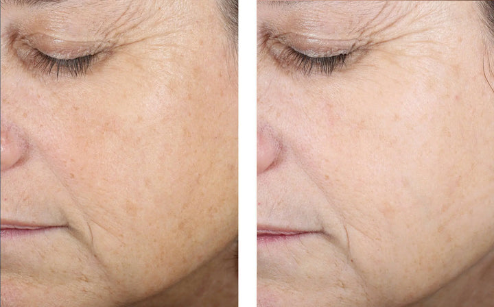 Even Tone Correcting Serum | Skinbetter