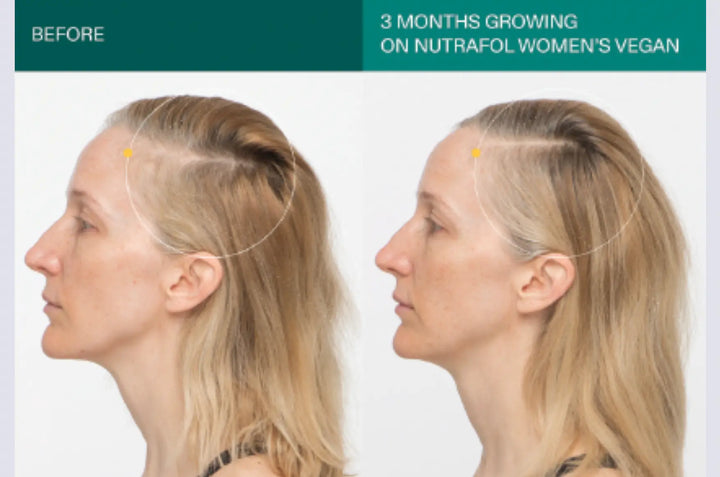 Nutrafol Women’s Vegan Growth Pack - 3 month&