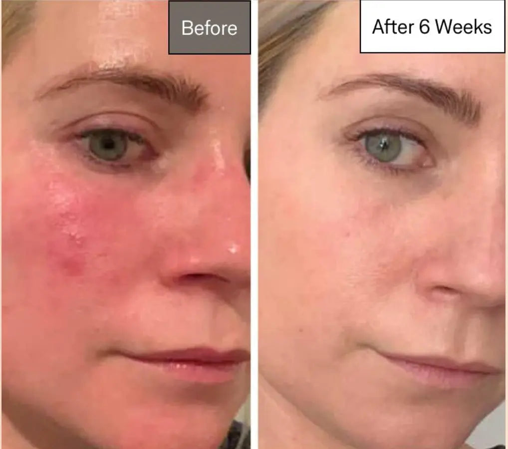 Omnilux Contour Face Medical-Grade LED Light OMNILUX Cleanse Face & Body Bar