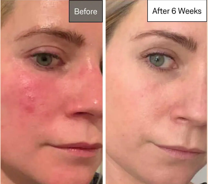 Omnilux Contour Face Medical-Grade LED Light OMNILUX Cleanse Face & Body Bar