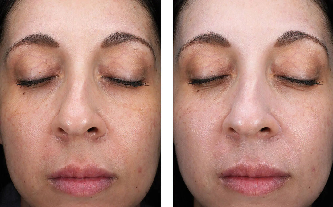 sunbetter SHEER SPF 70 Sunscreen Lotion before and after