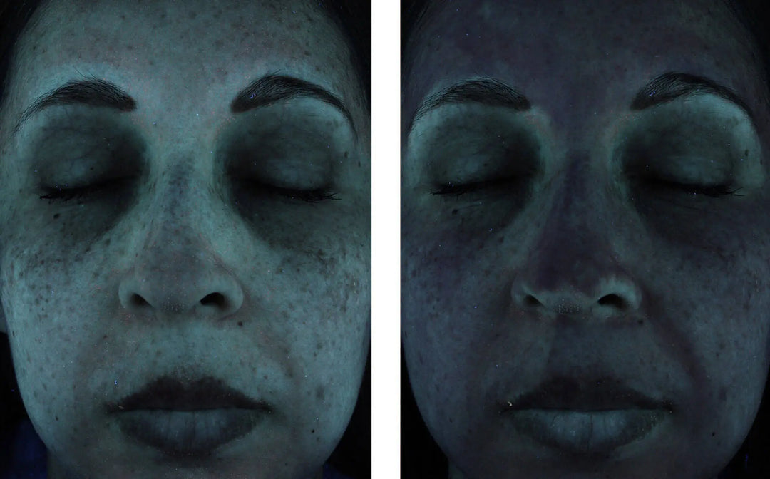 sunbetter SHEER SPF 70 Sunscreen Lotion results