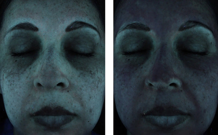 sunbetter SHEER SPF 70 Sunscreen Lotion results