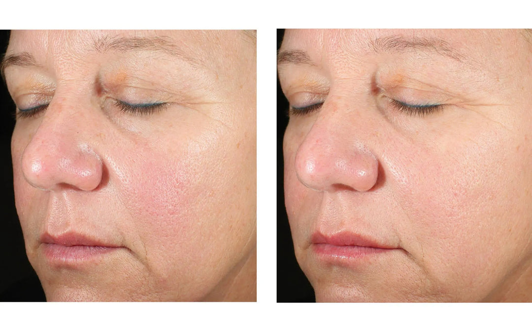 Skinbetter | Alto Advanced Defense and Repair Serum