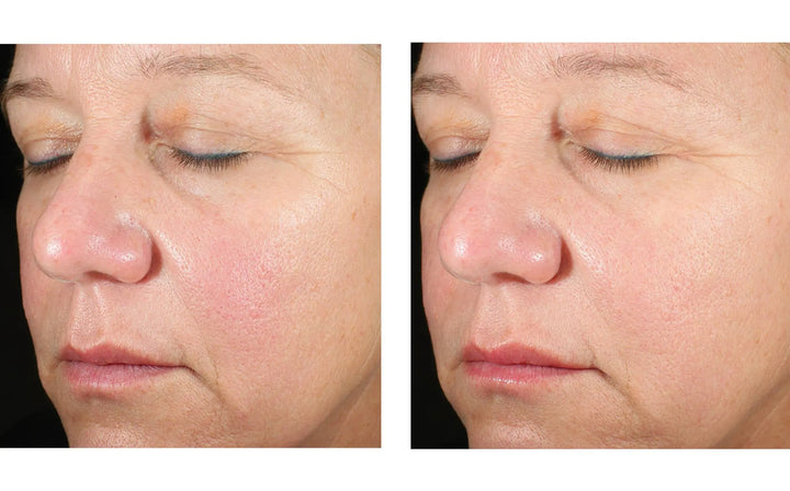 Skinbetter | Alto Advanced Defense and Repair Serum