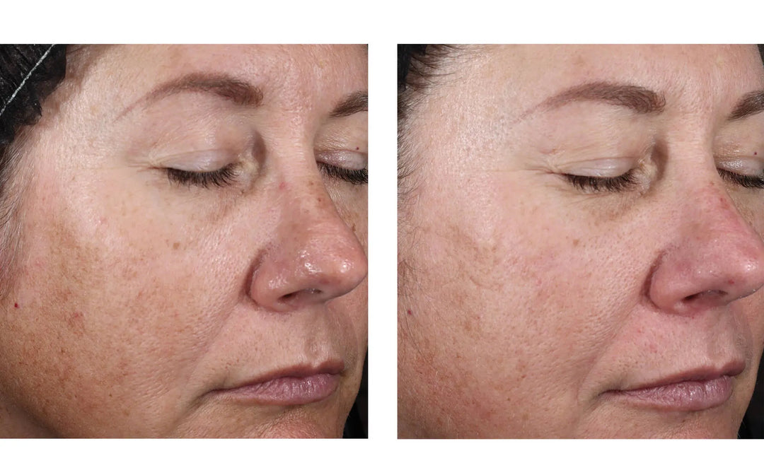 Skinbetter | Alto Advanced Defense and Repair Serum