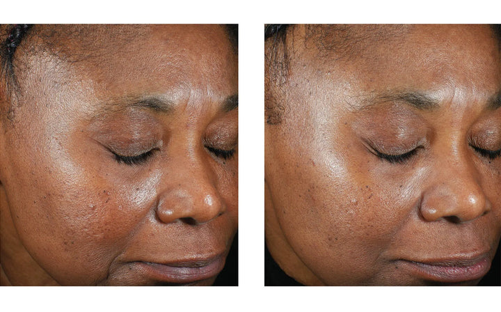 Trio Luxe Moisture Treatment | Skinbetter