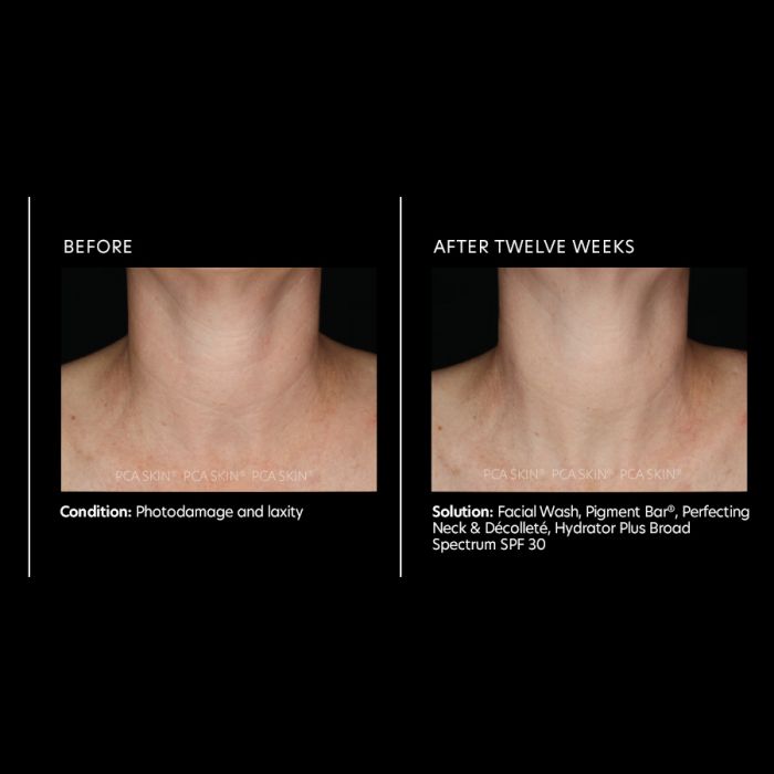 PCA SKIN® Perfecting Neck and Décolleté